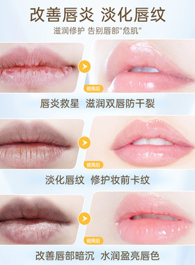 资生堂唇炎专用润唇膏官方正品