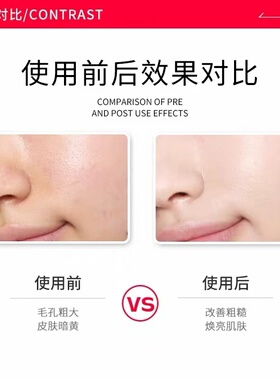 【自营】BbLAB苾莱宝复活草涂抹面膜175g保湿修护