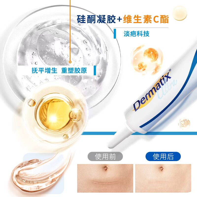 【自营】Dermatix倍舒痕祛疤膏30g产后术后增生去疤成人去疤膏