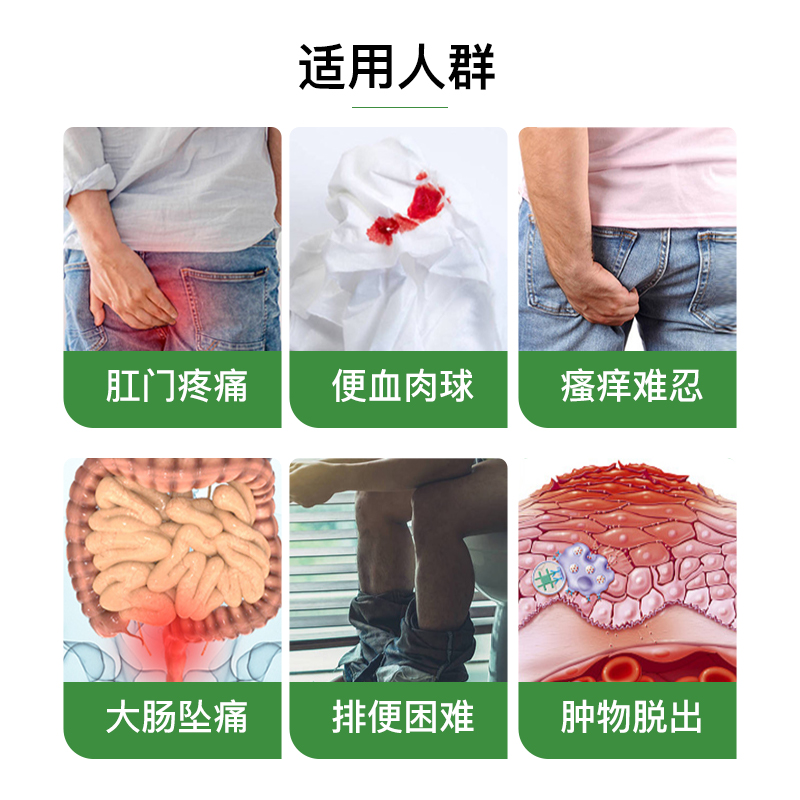 【自营】澳洲Proctosedyl痔疮膏 混合便血肛裂内外用消肉球痔疮栓 - 图1