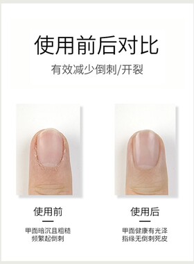 opi指缘护甲油营养液倒刺