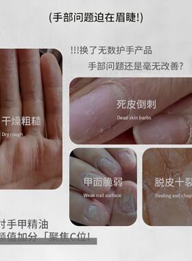 乌木玫瑰香氛滋润营养油护理呵护手部指缘肌肤精油保湿精油防倒刺