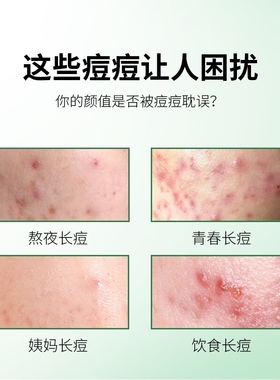 仁和匠心药业祛痘凝胶青春痘祛痘膏淡化痘印凝胶闭口男女正品