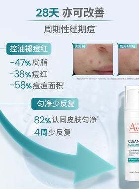 【双11抢先购】雅漾控油抗痘C位精华乳无酸控油祛痘褪红减瑕疵