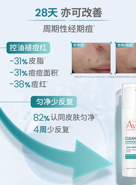 雅漾控油抗痘C位精华露0酸温和