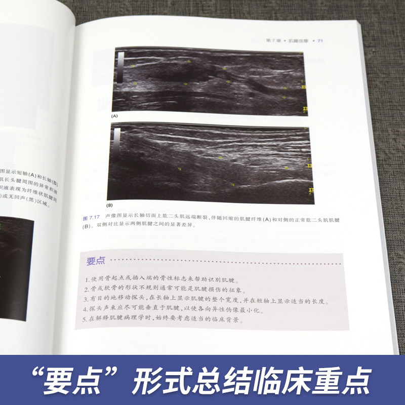 【官方直营】肌肉骨骼超声基础入门篇 超声基本理论及成像原理 仪器调节 超声物理学 多普勒成像 肌肉肌腱成像特点 超声引导下注射