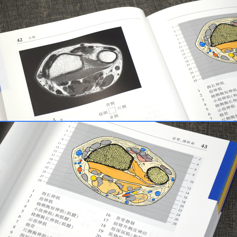 【现货出版社直发】CT与MRI袖珍断层解剖图谱第3卷：脊柱、四肢、关节放射解剖和精准的CT与MRI断层解剖图像医学影像学-图1