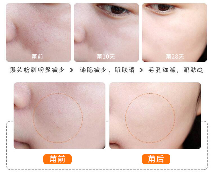 日本城野医生毛孔收敛收缩水 女去角化去黑头收毛孔化妆水爽肤水,淘宝优惠券,粉丝福利购,淘宝优惠卷