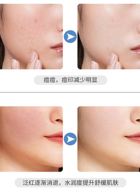 500克修护冰晶舒缓镇静