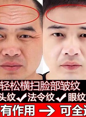 祛皱纹美白神器去除抬头纹男女提拉紧致六胜肽抗皱美白面霜抗衰老