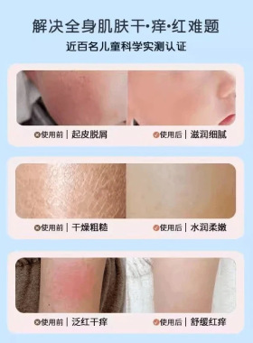 儿童凡士林身体乳干燥补水保湿滋润婴幼儿用润肤乳秋冬