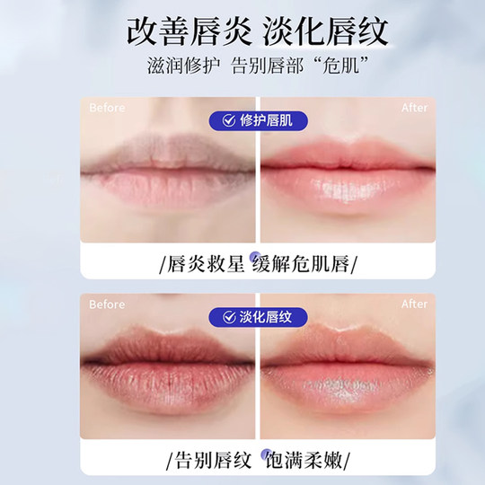 资生堂润唇膏维生素滋润保湿补水修护防干裂唇炎膜专用女男正品店