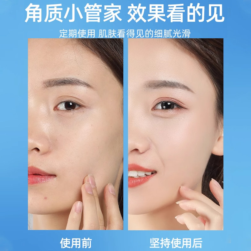 日本cure深层清洁去角质面部女毛孔非珂润磨砂膏洁面啫喱（临期）,淘宝优惠券,粉丝福利购,淘宝优惠卷