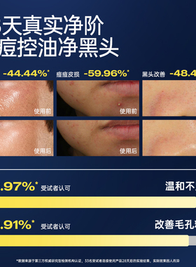 [极男控油祛痘洗面奶]爆卖840W+