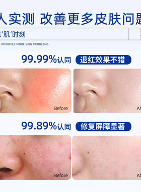 面霜修复皮肤屏障女士舒缓敏感肌修护泛红干皮美容院抗老保湿正品