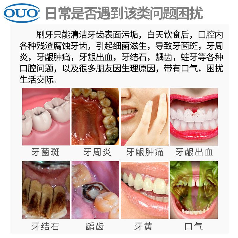 ouo去牙渍异味孕产妇 笛梵漱口水