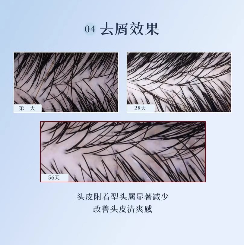 PHYTO发朵效护发护甲内调配方鱼油营养保健品养发胶囊口服120粒,淘宝优惠券,粉丝福利购,淘宝优惠卷