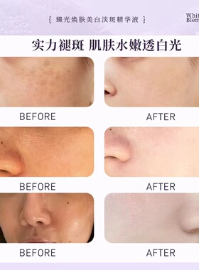 NCCU377臻光焕肤美白淡斑精华液祛黄提亮紧致抗皱