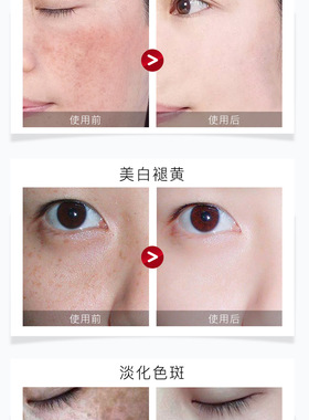 祛斑霜美白淡斑正品去斑
