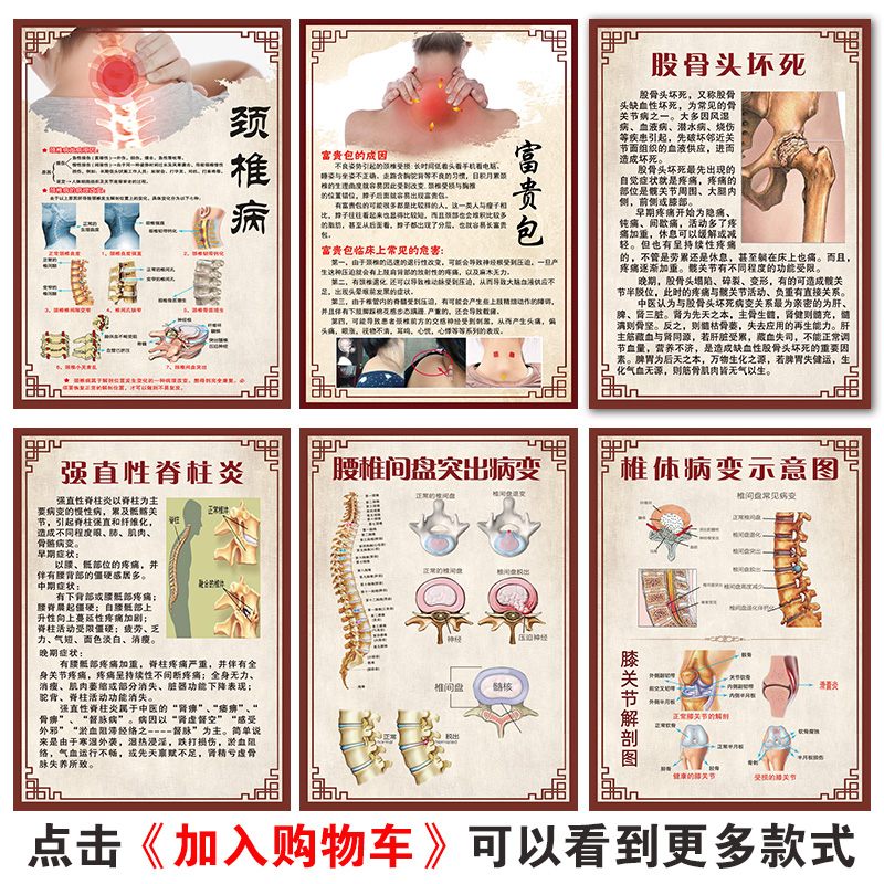 颈椎图片膝关节炎宣传画骨质增生挂画脊柱图腰椎病症图肩周炎海报 - 图0