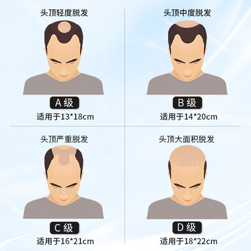 假发男士双递针真发仿真隐形头顶补发片全手织地中海秃头男生补发 - 图2