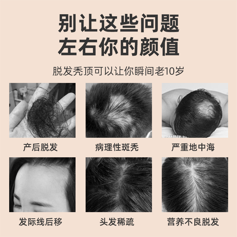 鸢苏育发液【官方正品】鸳莺发际线 鸢苏洗发水