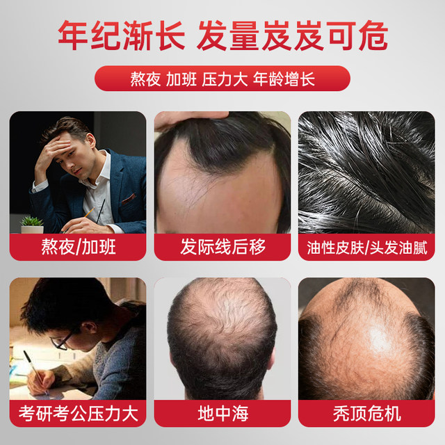ການຂະຫຍາຍຕົວຜົມ biotin ຂອງຜູ້ຊາຍ swiss