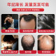 ການຂະຫຍາຍຕົວຜົມ biotin ຂອງຜູ້ຊາຍ swiss