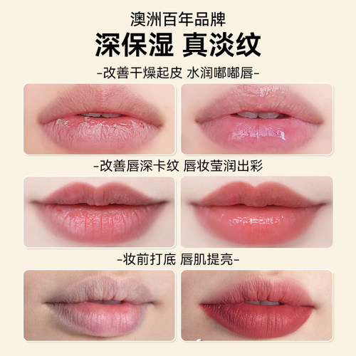 Real木瓜膏Lucas润唇膏女唇膜蚊虫叮咬婴儿霜防干裂澳洲官方正品 - 图2
