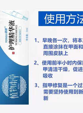 指甲增长液甲床增长修复生长液咬啃指甲生长水指甲修复液受损再生