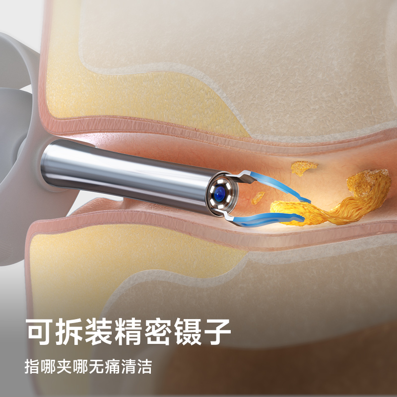 可视掏耳勺高清儿童耳朵清理神器发光带镊子耳挖勺抠扣挖耳屎工具 - 图1