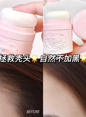 NOVO天使羽盈发际线蓬蓬粉控油干发粉免洗神器懒人头发蓬松去油