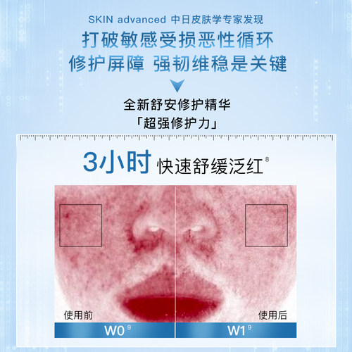 卓沿舒安屏障修护精华液30ml舒缓维稳泛红B5保湿水润敏感肌 - 图2