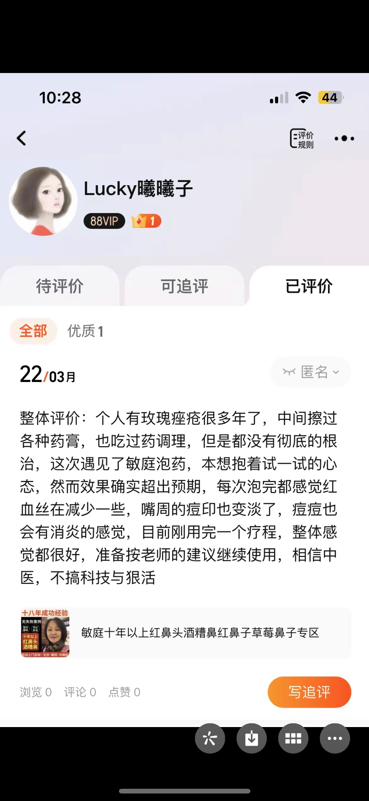 敏庭酒糟鼻草莓鼻子修复酒糟鼻专用药鼻子红血丝修复鼻子两边泛红 - 图2