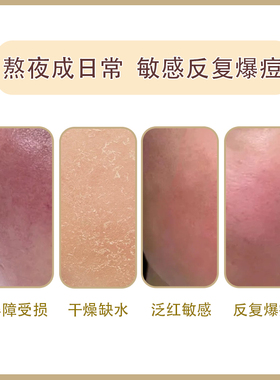 胶原舒缓呵护愈肤精华油芳香精油与中式本草的舒缓愈颜强韧之力