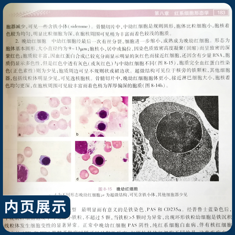 正版骨髓细胞与组织病理诊断学 2020年4月参考书骨髓细胞与组织病理诊断学卢兴国叶向军徐根波主编人民卫生出版社-图1