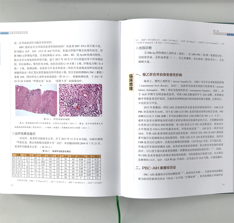 正版疑难肝胆病临床思维疑难肝病罕见肝病遗传代谢性肝病案例福建科学技术出版社可搭肝胆病辨证脾胃肝胆病分册购买-图1