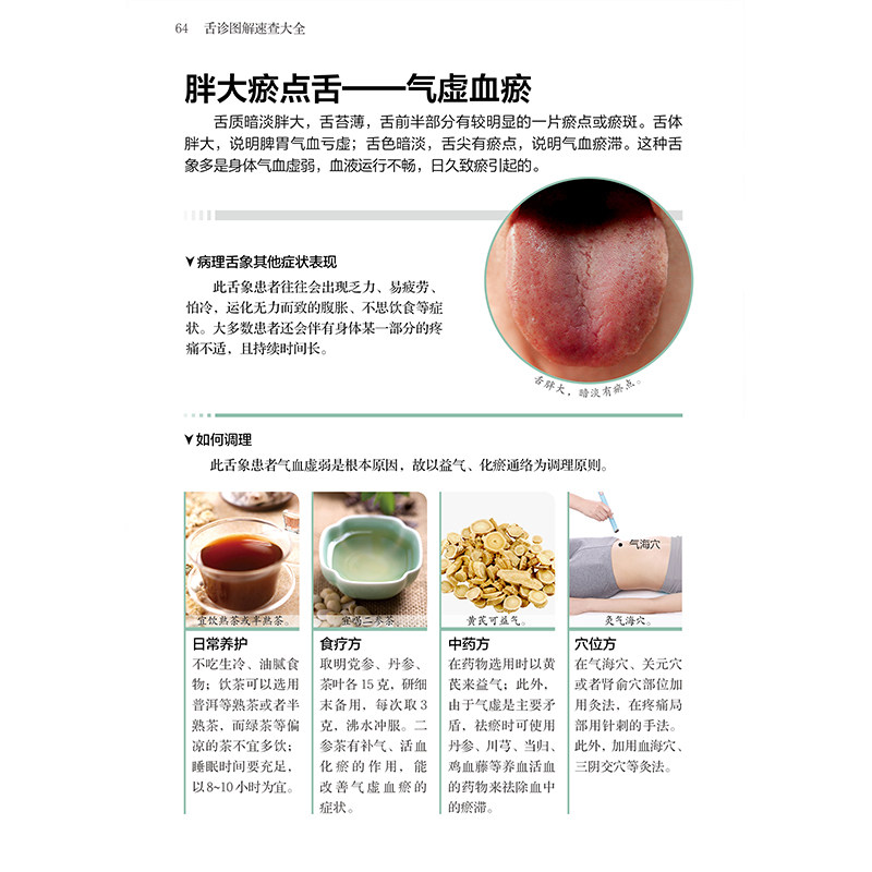舌诊图解速查大全 舌诊入门 学习舌诊先认舌 舌诊与人体辨别疾病的根据 舌诊在疾病诊治中的意义  舌诊的方法及注意事项