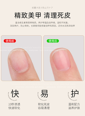 卡妞软化死皮美甲软化剂去除倒刺