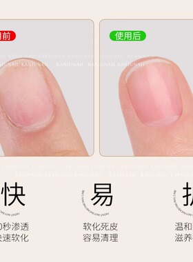 卡妞软化剂去角质边缘美甲工具