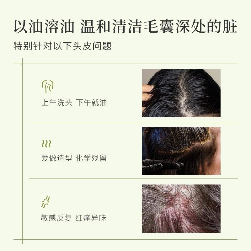 自漾头皮清洁油预洗油 净化控油舒缓防断润发滋养 改善头发头皮油,淘宝优惠券,粉丝福利购,淘宝优惠卷