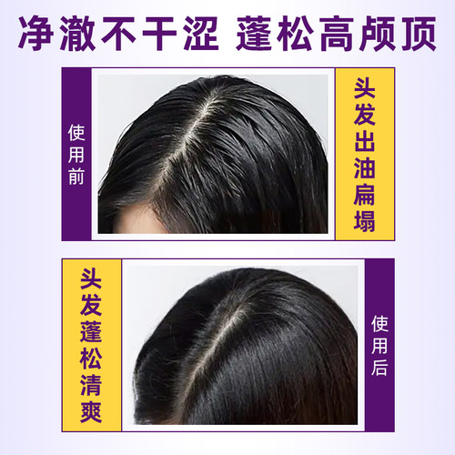 aussie澳丝袋鼠轻盈丰盈蓬松水润椰子护发素奇迹去油蓬松控油海盐 - 图0