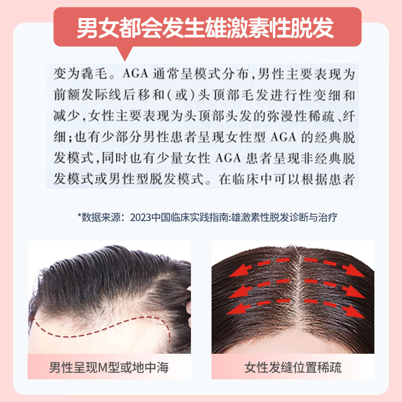 蔓迪米诺地尔酊正品女性生发液发际线增长育发液5%曼迪官方旗舰店
