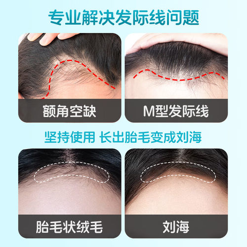 蔓迪精灵瓶米诺地尔酊男女性生发液正品曼迪米诺地尔町官方旗舰店 - 图1