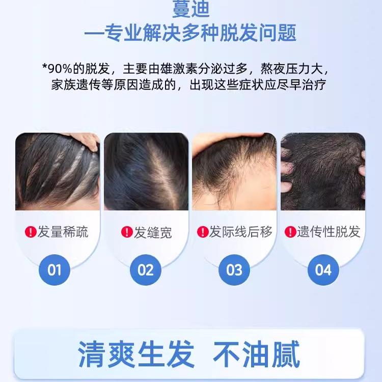 蔓迪米诺地尔酊90ml正品5%男用米洛尓町酊生发液官方旗舰店曼迪