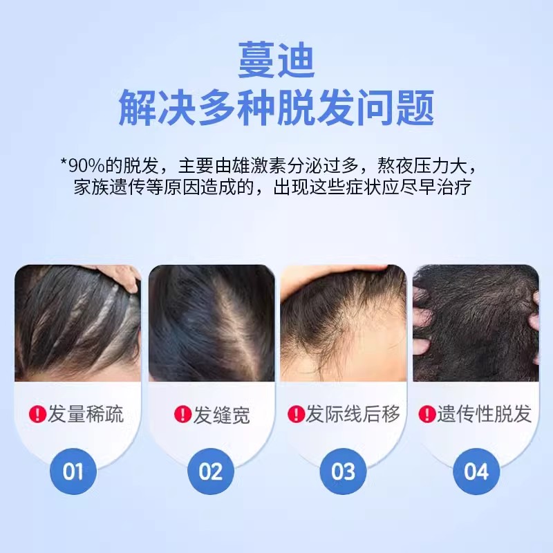 蔓迪米诺地尔酊90ml*4瓶男用脱发曼迪米诺地尓酊正品官方旗舰店