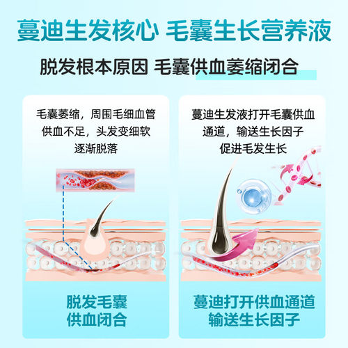 蔓迪精灵瓶米诺地尔酊男女性生发液正品曼迪米诺地尔町官方旗舰店 - 图2