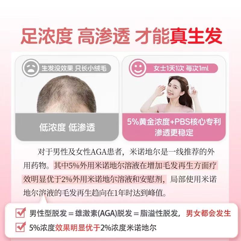 蔓迪米诺地尔酊正品女性生发液发际线增长育发液5%曼迪官方旗舰店
