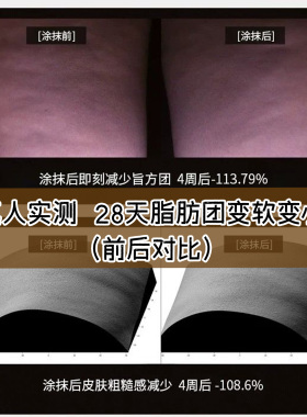 Suelo火山身体PPC纤体刮痧美体霜