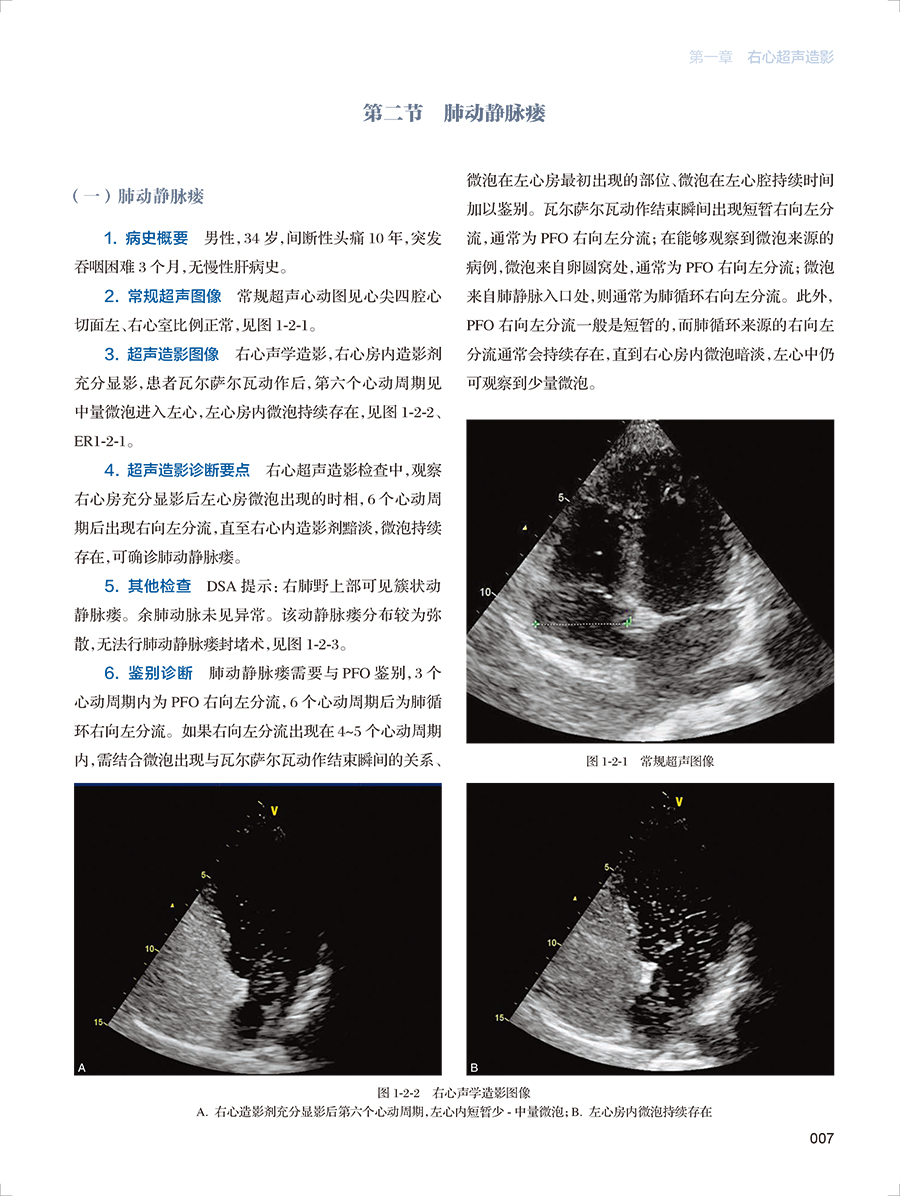 心血管超声造影图鉴 中国医师协会超声分会超声造影图鉴丛书 超声医学医师病例诊断 静态动态图像图谱妇产科妇科超声检查指南手册 - 图2